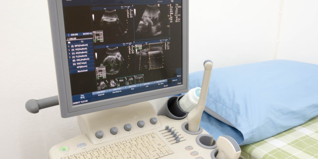 La desinfección de transductores de&nbsp;ecografía